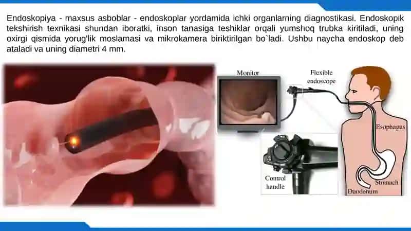 Endoskopiya 2
