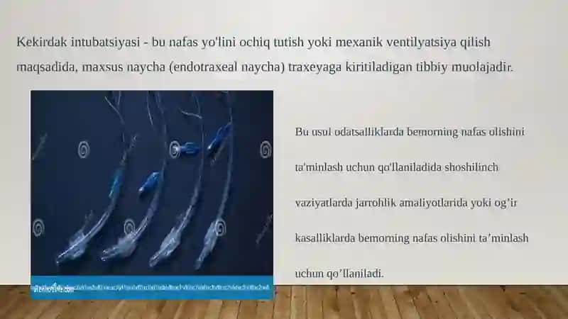 KEKIRDAK INTUBATSIYASI. TRAXEO - BRONXOSKOPIYA 2