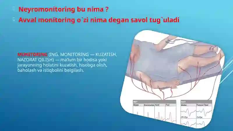 Neyromonitoring 2