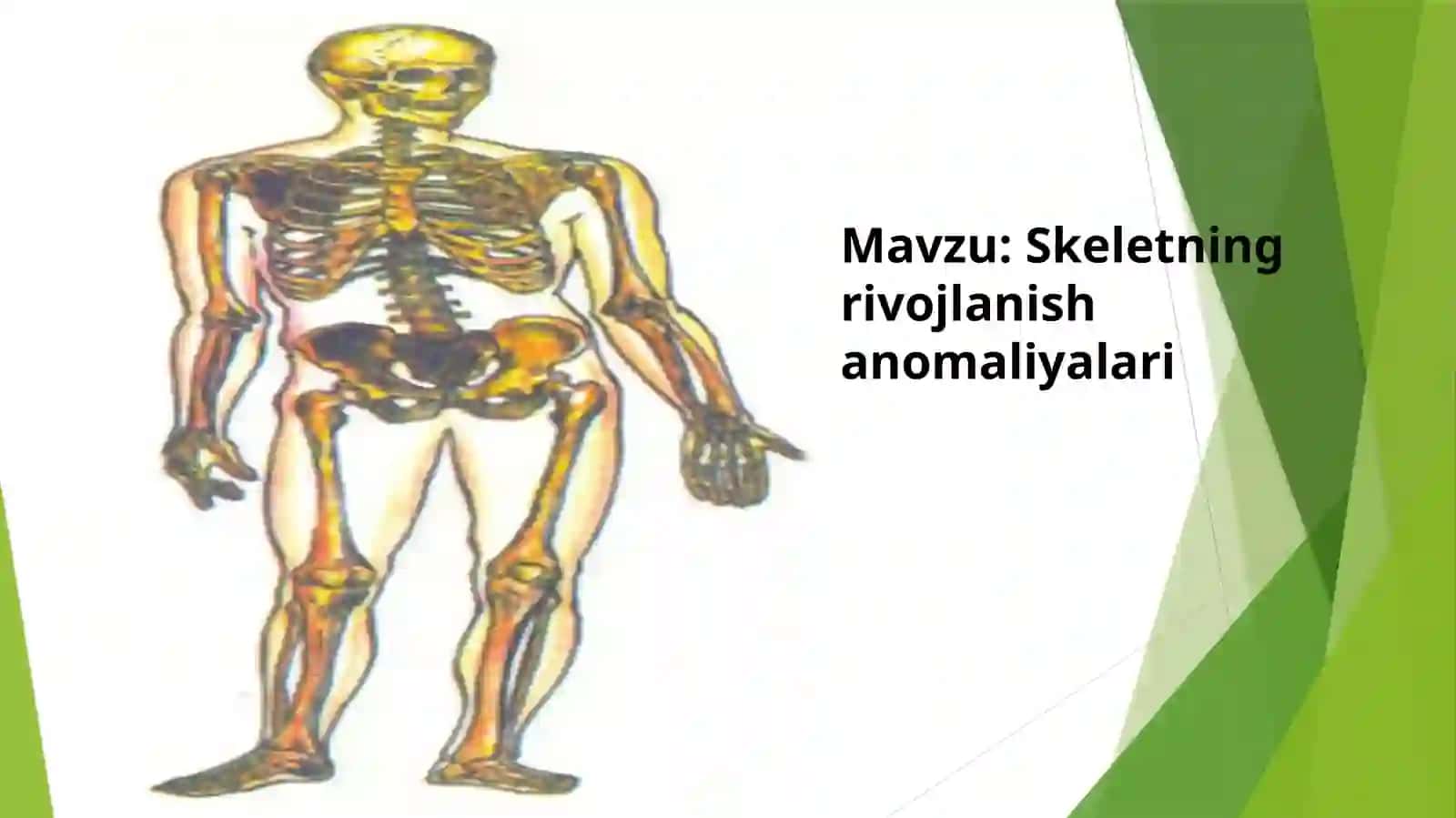 Skeletning rivojlanishanomaliyalari 2