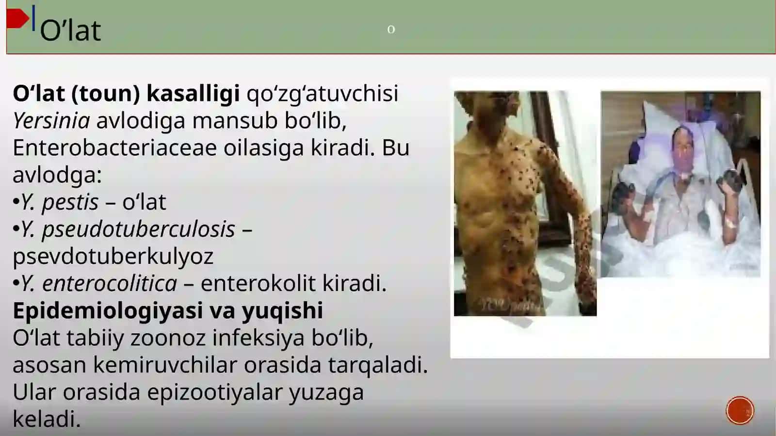 Oʻta havli yuqumli kasallik qoʻzg'atuvchilari O'lat, vabo kuydirgi brutselyoz 2
