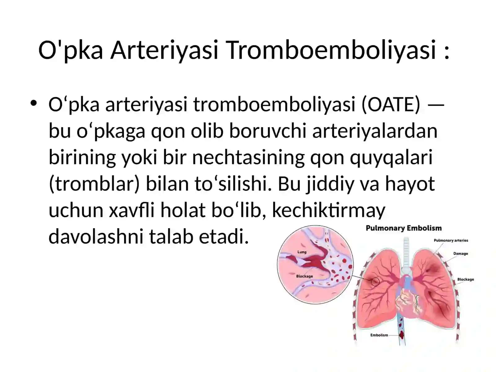 O‘pkaarteriyasiTromboemboliyasi 2