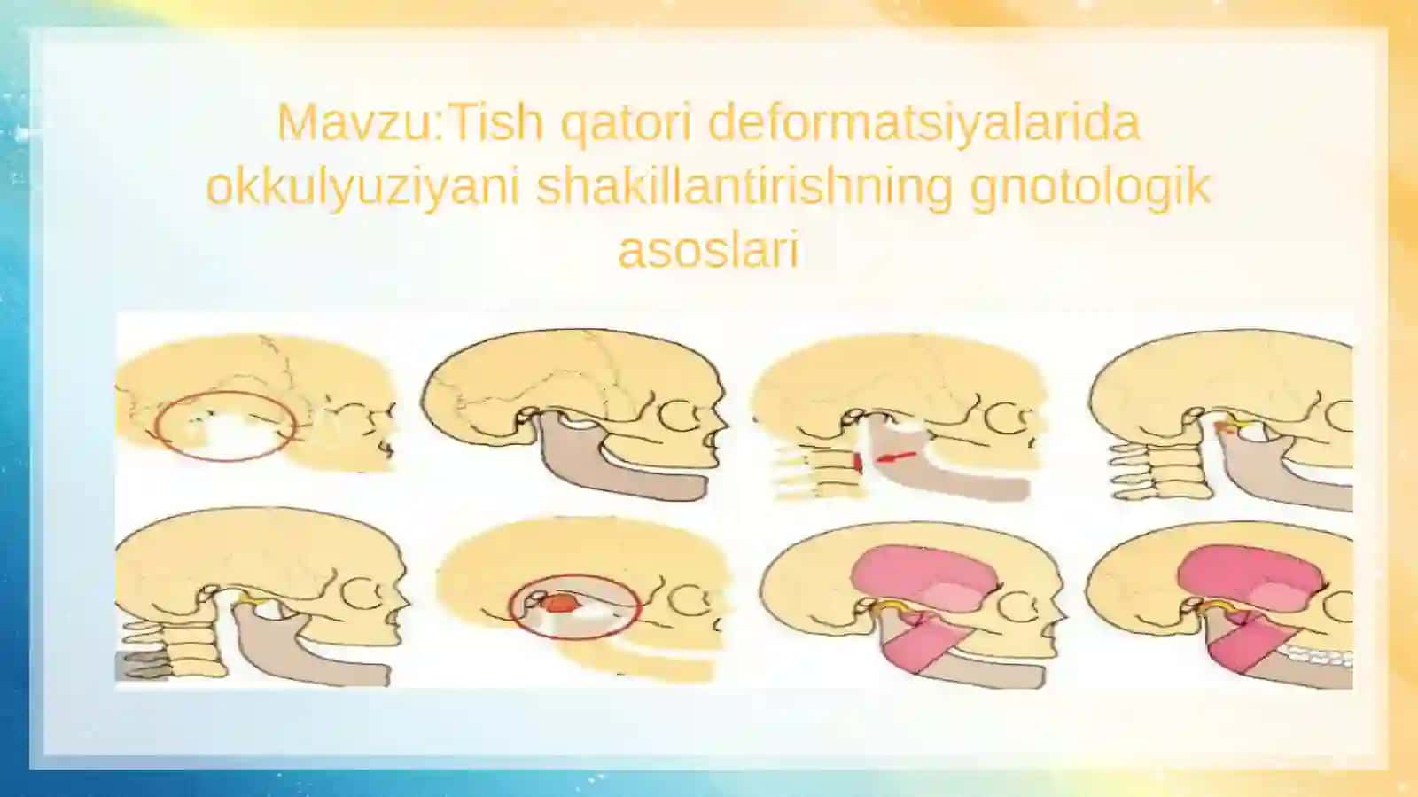 Tish qatori deformatsiyalarida okkulyuziyani shakillantirishning gnotologik asoslari 2