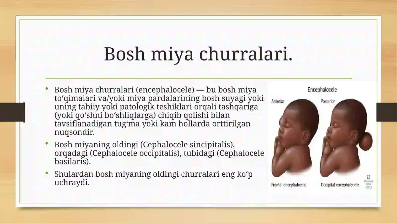 Boshmiyavaorqamiyatug‘marivojlanishnuqsonlari 2
