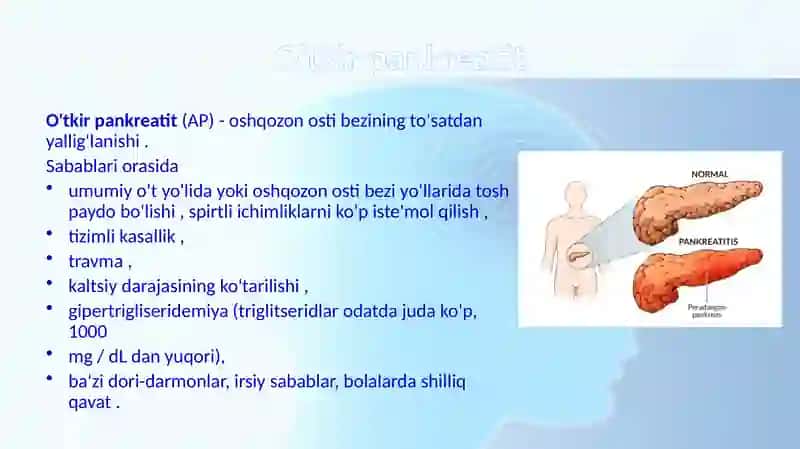 Otkir pankreatit 2