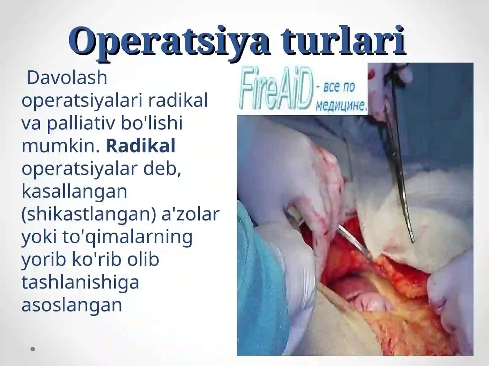 Xirurgik operatsiya turlari. Operatsiya oldi va keyengi davrlar 2