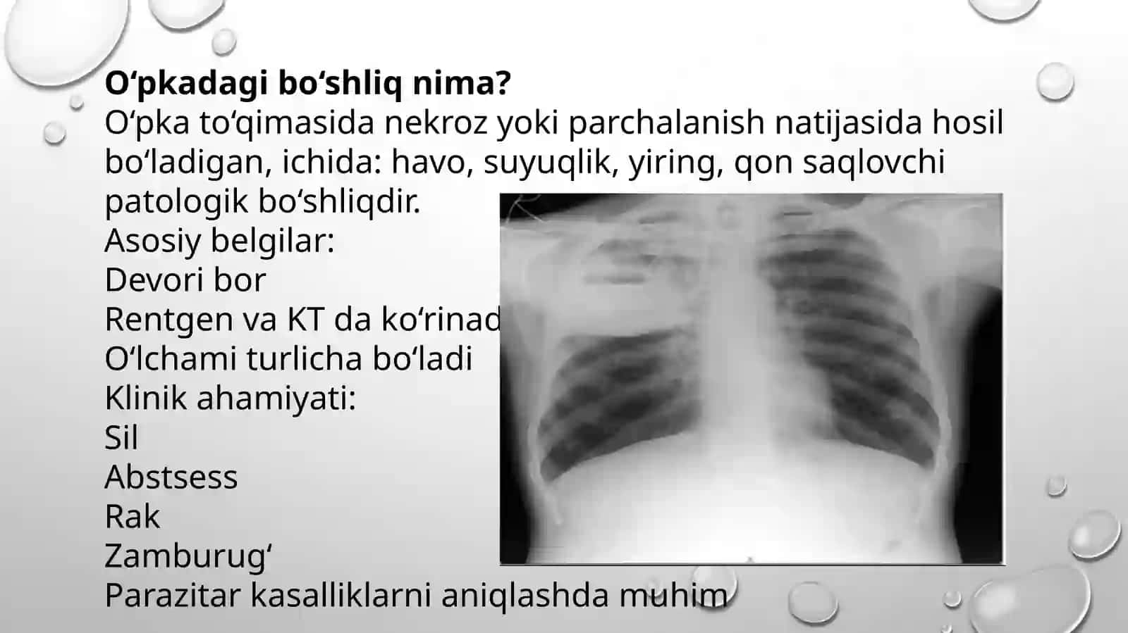 Oʻpka ichidagi boʻshliqlarni qiyosiy tashxislash 2