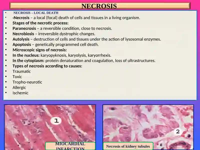 NECROSIS Lecture 2