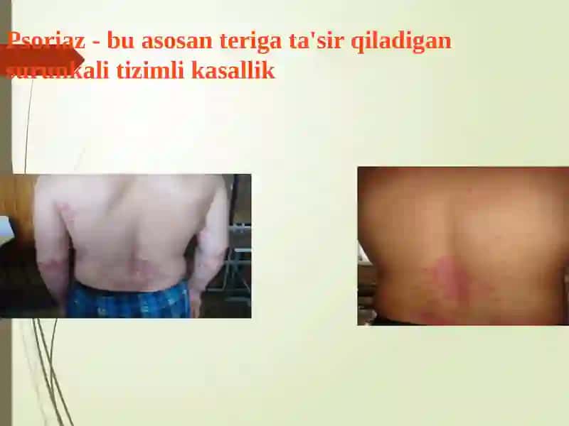 Genodermatozlar 2