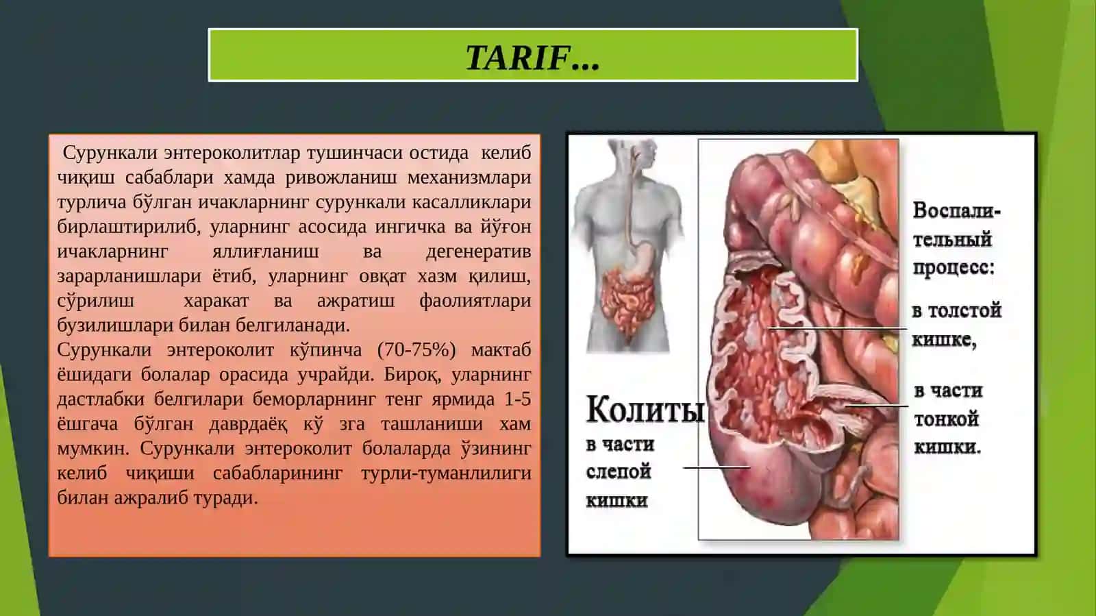 Surunkali Enterokolit;Etiologiyasi,Patogenizi,Klinikasi,Differinsial–Diagnostika,DavolashTamoillari… 2