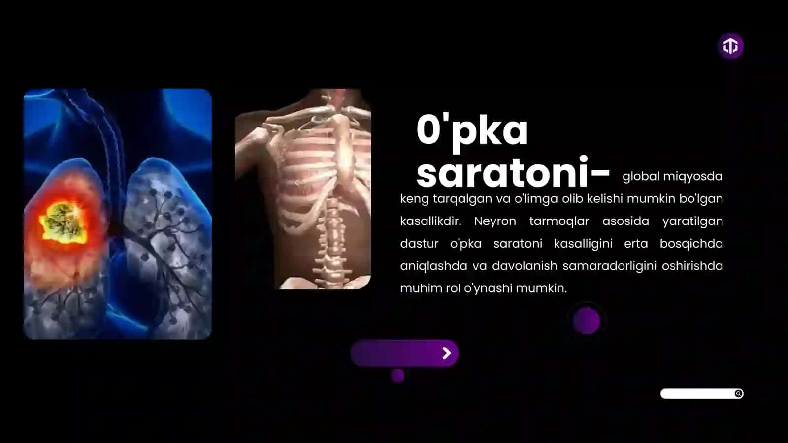 Neyron Tarmoqlar Asosida O‘pka Saratoni Kasalligini Aniqlash Dasturini Ishlab Chiqish 2