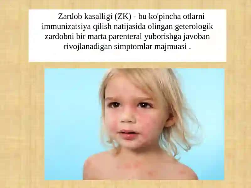 Zardob kasalligi 2
