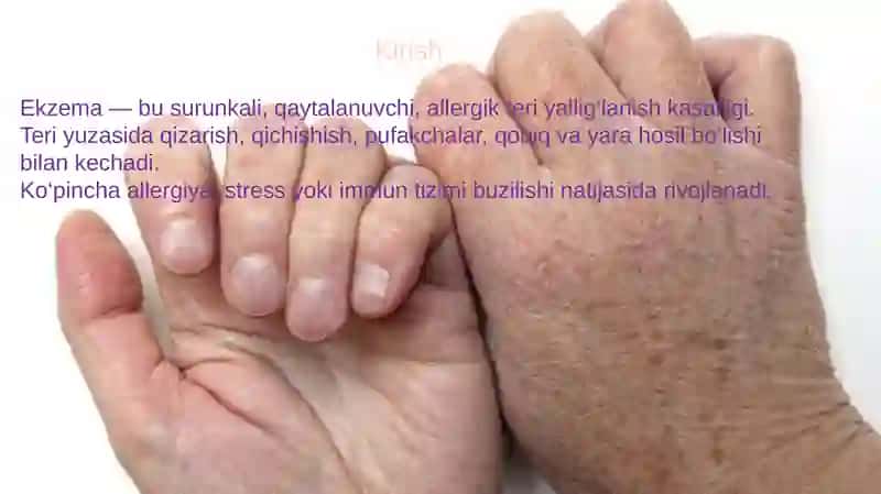 EKZEMA kasalligi 2