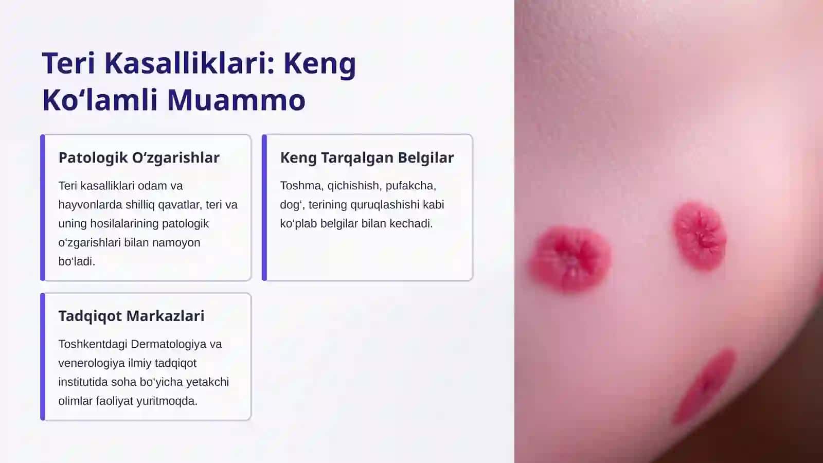 Terining Turli Kasalliklari va Gelmintozlar 2