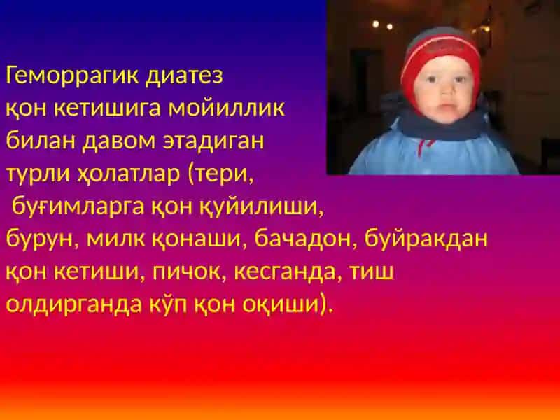 Геморрагик диатезлар 2