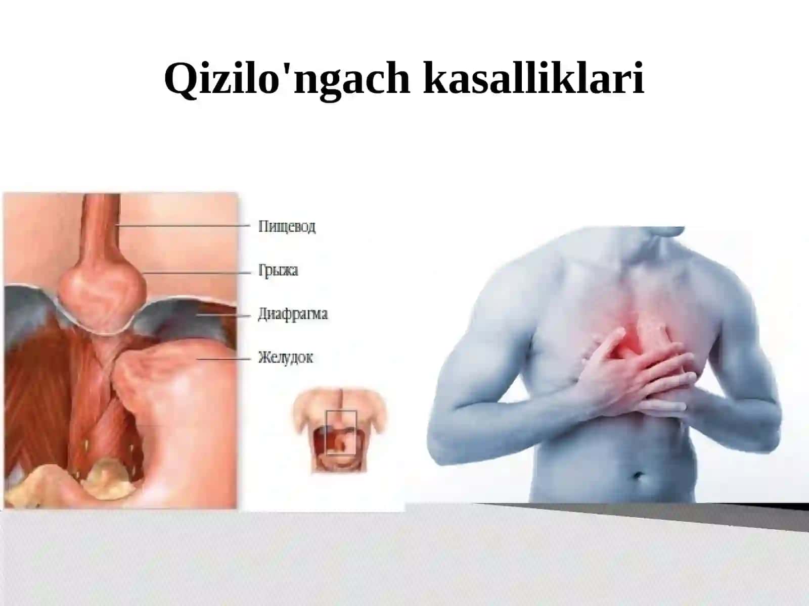 Xazm qilish kasaliklari 2