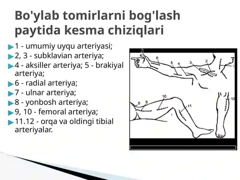 Qon tomir varentgen endovaskulyar jarrohlik 2