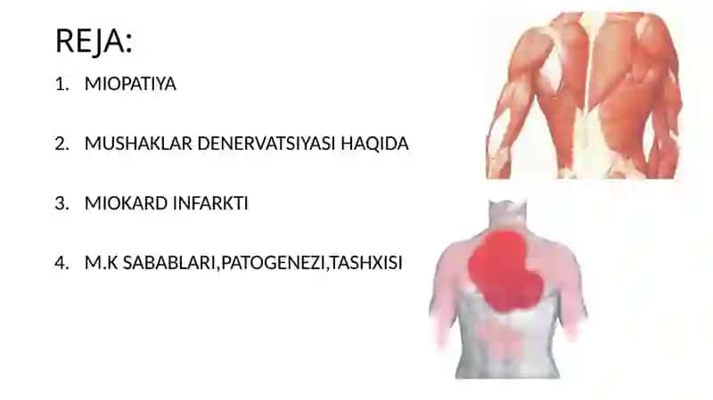 MIOPATIYA.MUSHAKLAR DENERVATSIYASI” VA “MIOKARD INFARKTI VA UNGA ERTA VA KECH TASHXIS QO’YISH 2