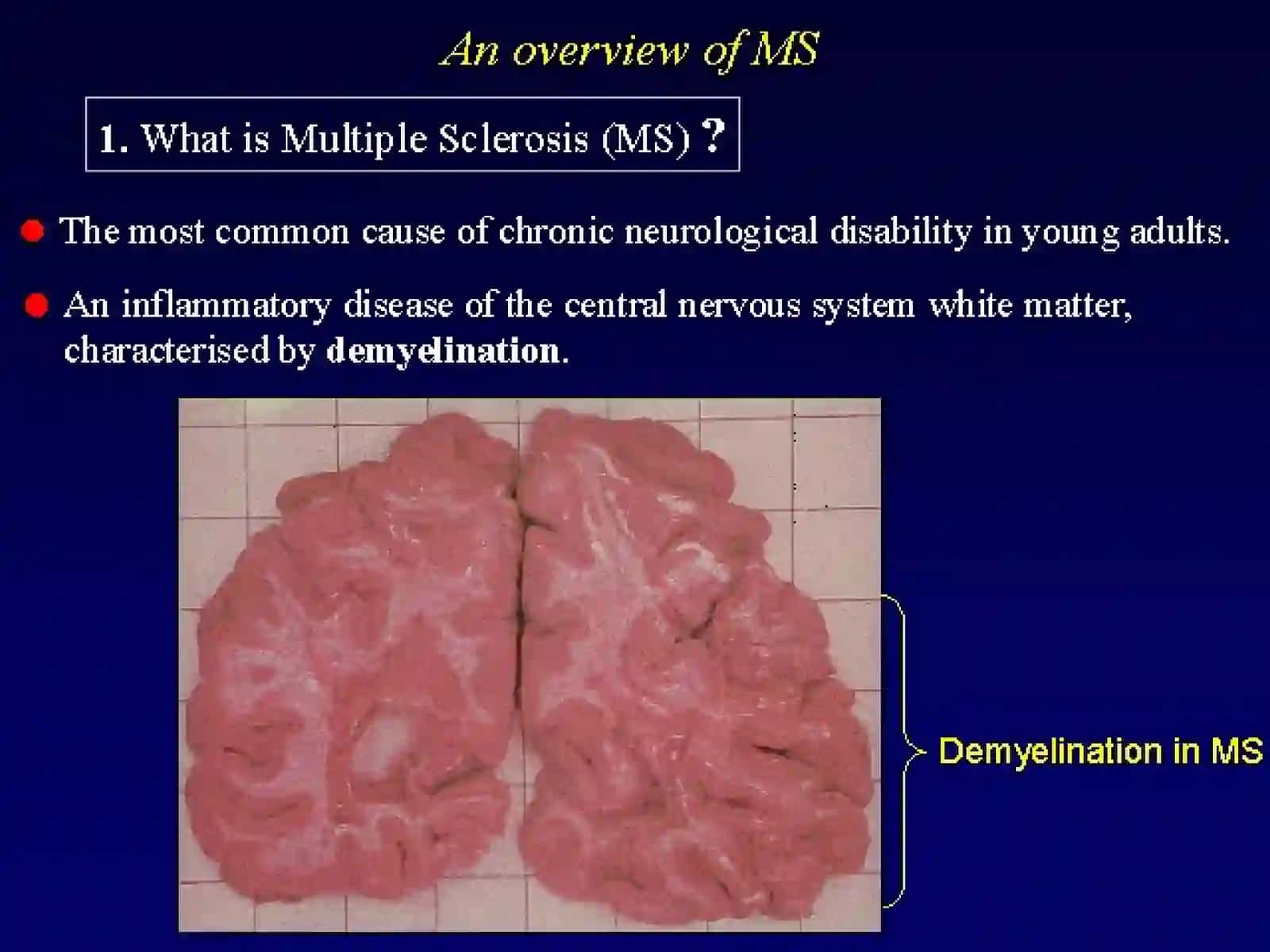 MS Pharmacotherapy 2