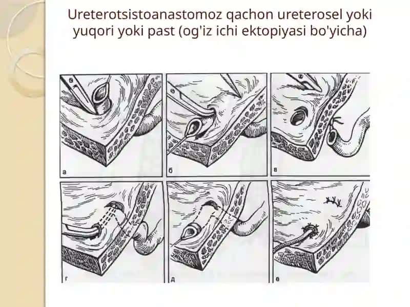 Jinsiy olat tug’ma rivojlanish nuqsonlari 2