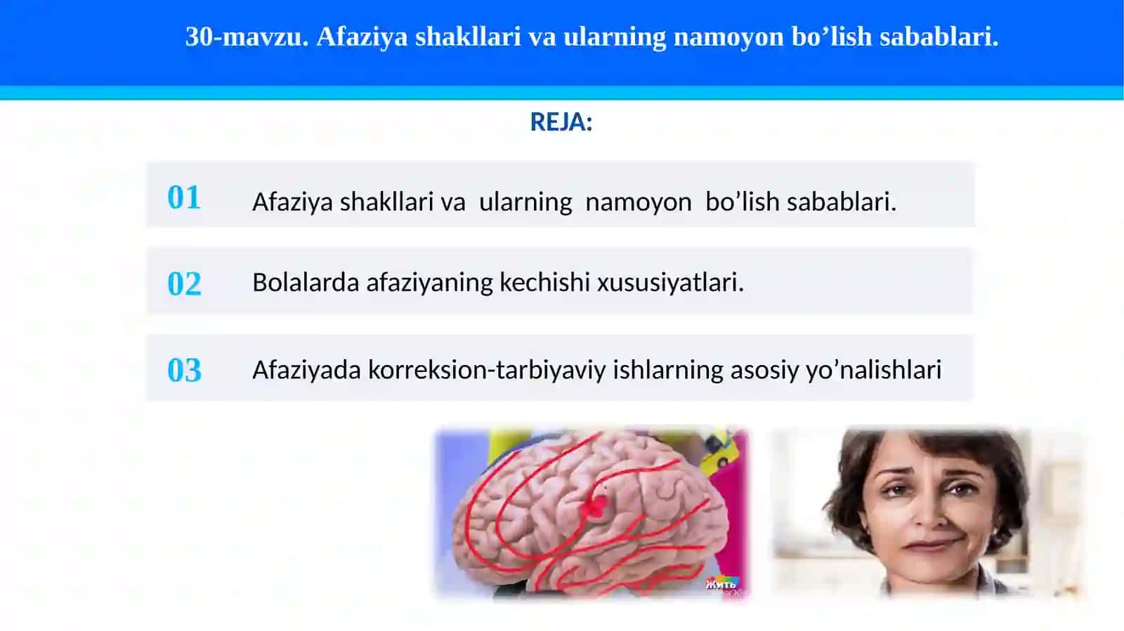 Afaziya shakllari va ularning namoyon bo’lish sabablari 2