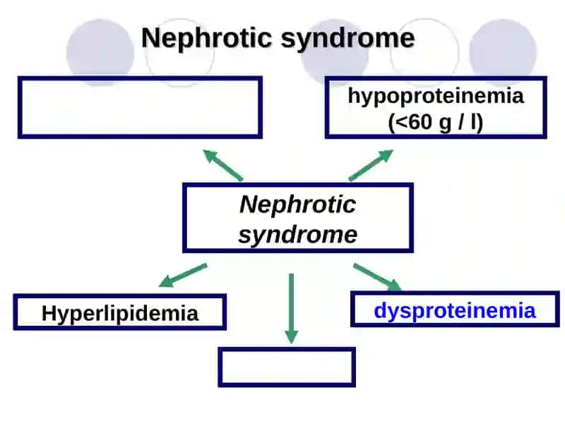 Differential diagnosis of nephrotic syndromeTactics of GP 2