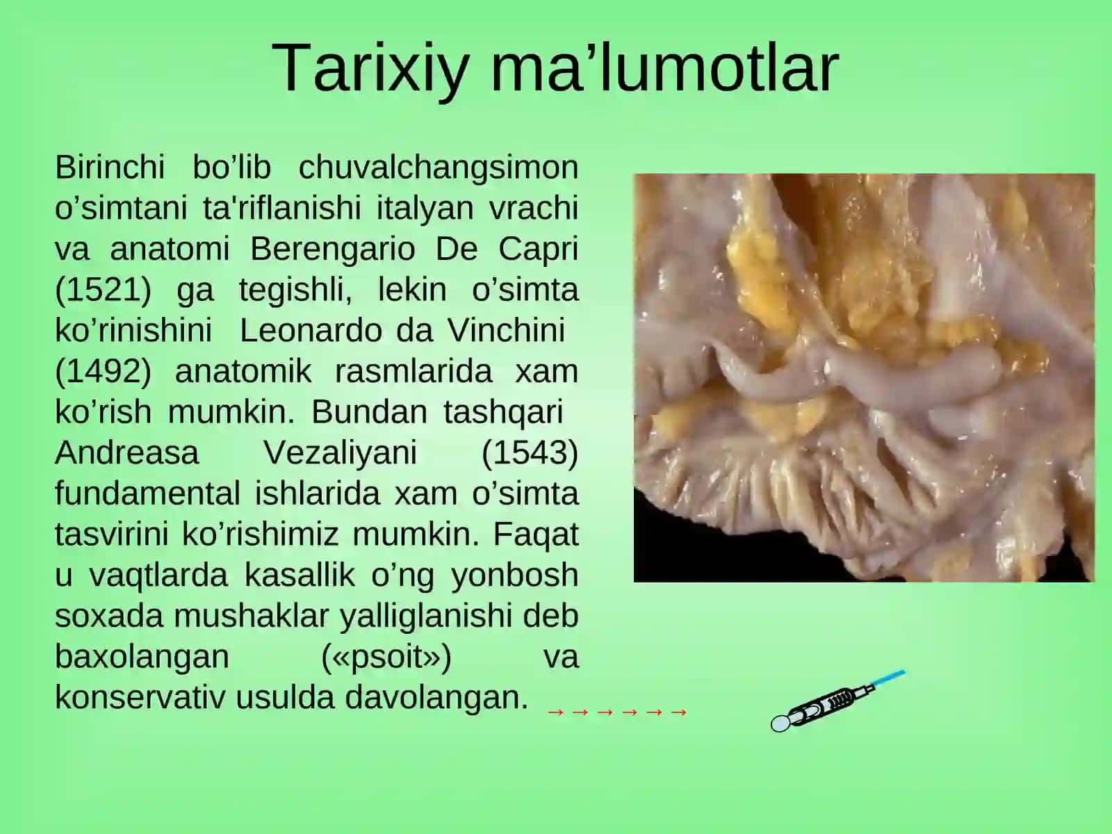 O'tkir appenditsit va uning asoratlari 2