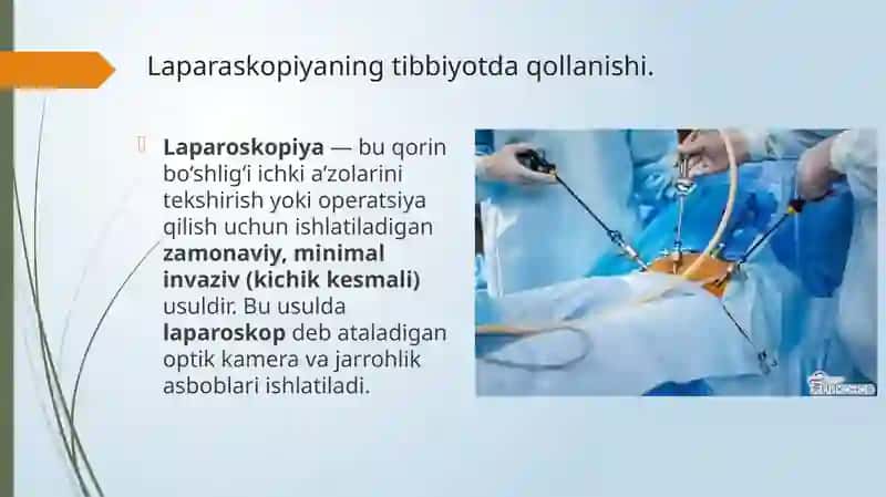 Laparoskopik herniotomiya 2
