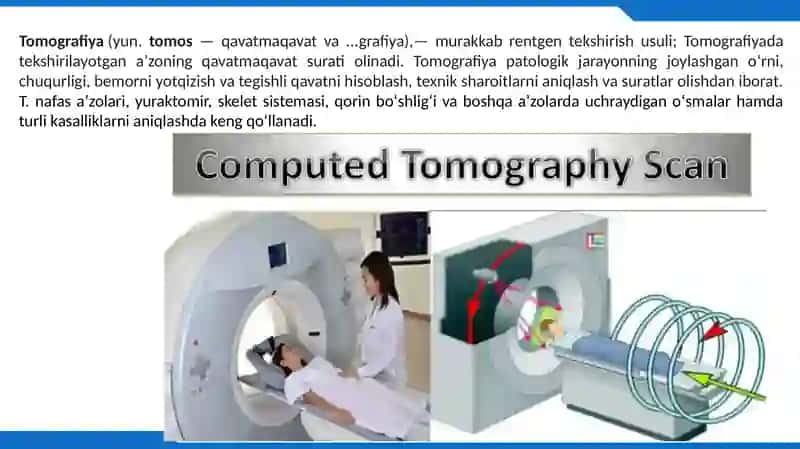 Kompyuter tomografiyasi 2