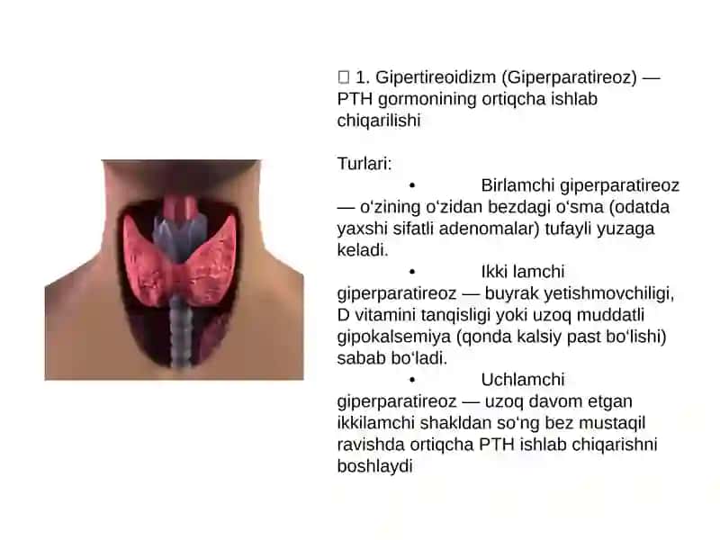 Qalqonoldi bezi kasalliklari .Gipo va giperparatireozlar 2