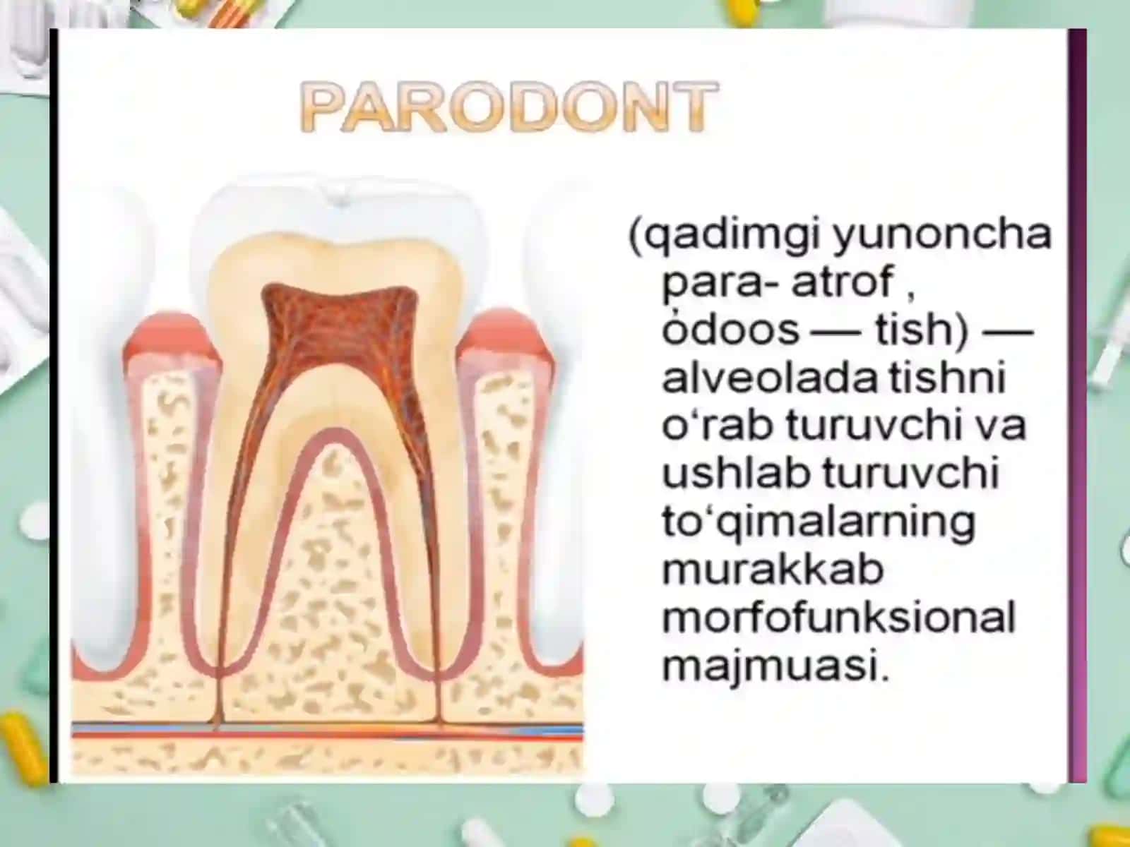 Paradontit 2