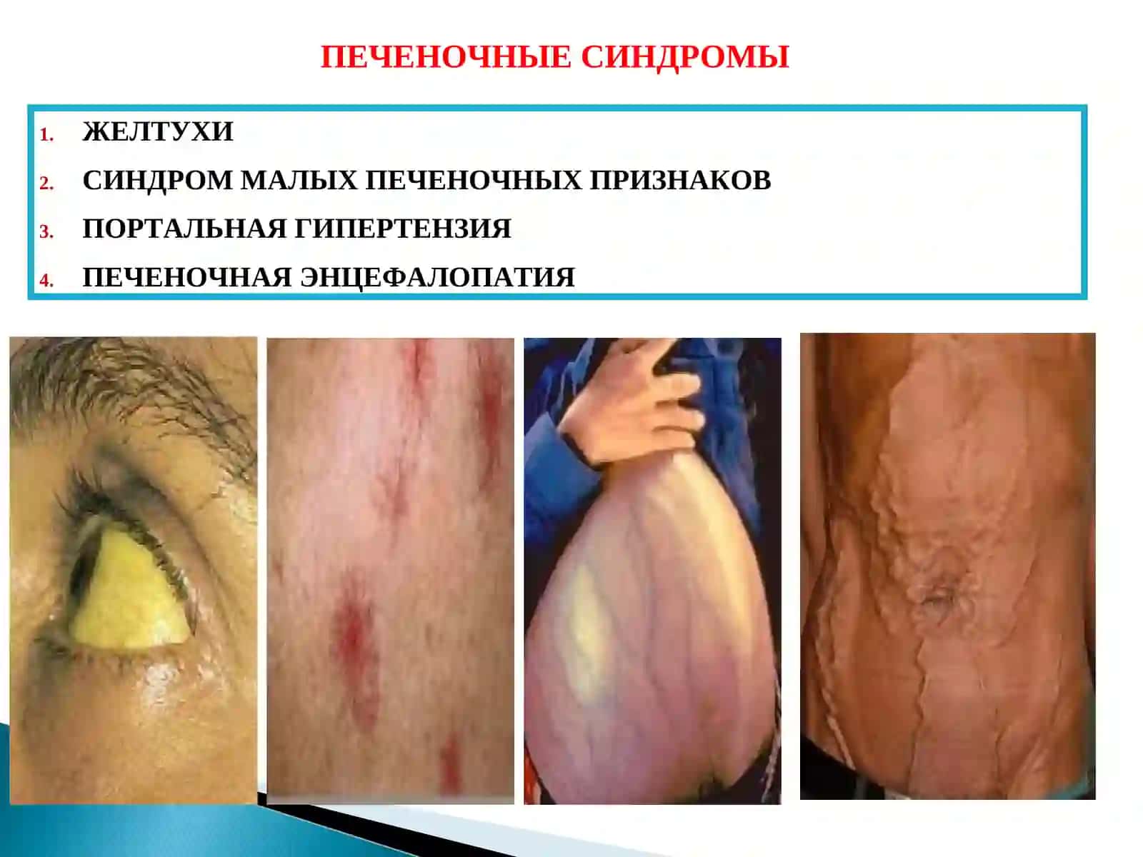 ЖЕЛТУХИ 2