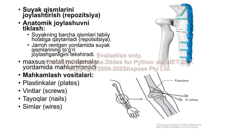 Suyaklarni rivojalinishini buzilishlari Sinishlar. Osteonekoroz 2