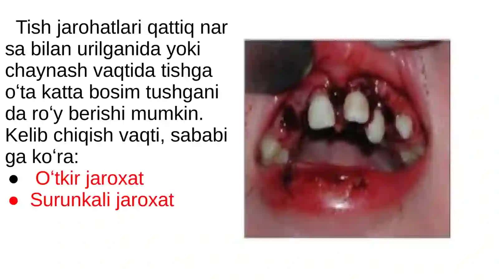 Tish chiqqanidan keyin paydo boʻladigan nokariyes kasalliklar. Tishlarni mexanik va kimyoviy jarohatlari. Klinikasi, tashxislash, va qiyosiy tashxii 2