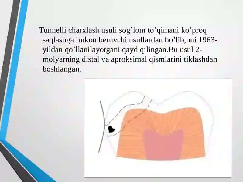 Tunnellicharxlash 2