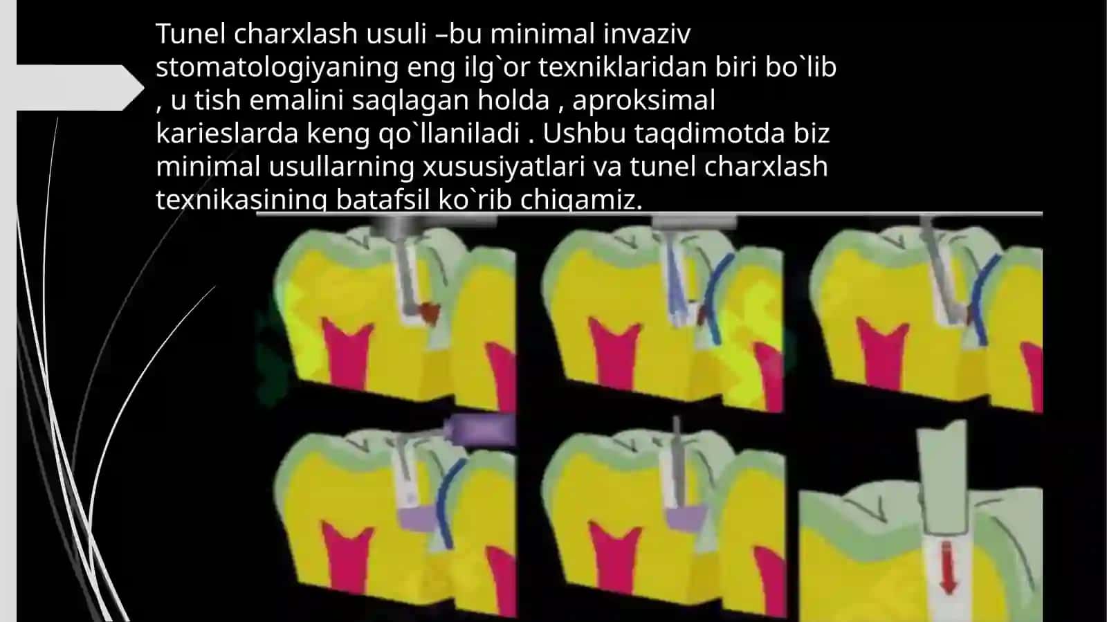 Tunel charxlash usuli 2