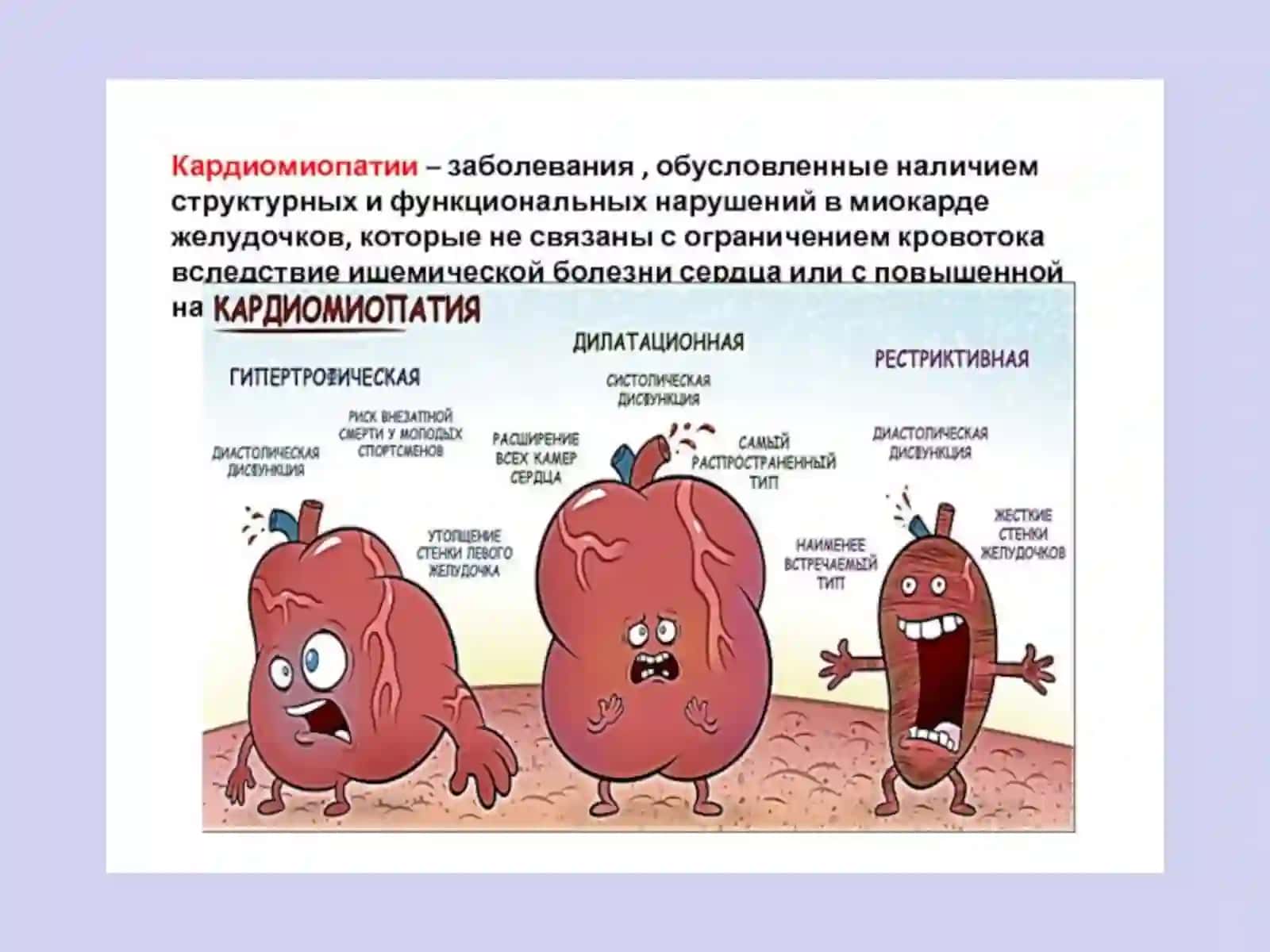 КАРДИОМИОПАТИИ 2