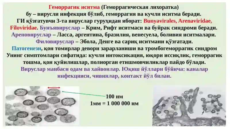 Ўта хавфли инфекциялар, геморрагик иситма. Куйдирги. Ўлат. ВАБО эпидемиология, этиология, патогенез ва патологик анатомияси 2