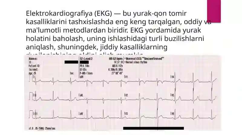 Komyuter tizimlarining Elektrokardiografiya (EKG) olish uchun ishlatilishi 2