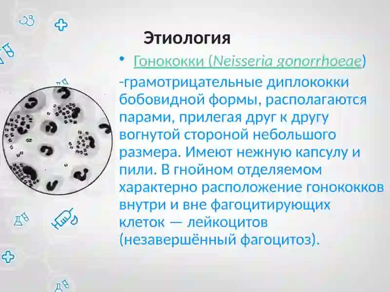 Гонорея 2