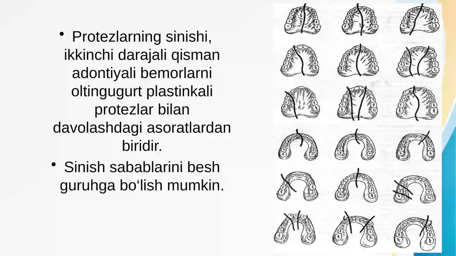 To’liq olib qo’yiladigan tish protezlaridan foydalanish muddatini uzaytirish: qayta bazislash, tuzatish,yamash. 2