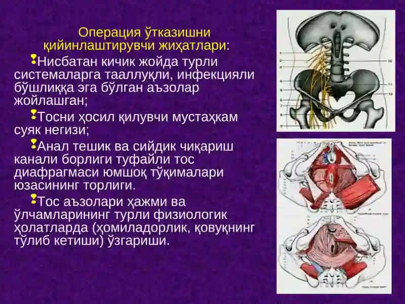 Тос чаноғи топографик анатомияси. Тос бўшлиғи аъзоларида асосий операциялар 2