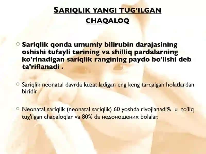 Sariqlik yangi tug'ilgan chaqaloqlar 2