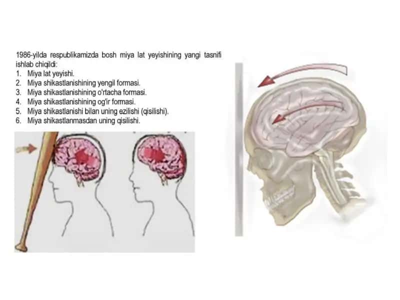 bosh, koʻkrak qafas va qorin shikastlari 2