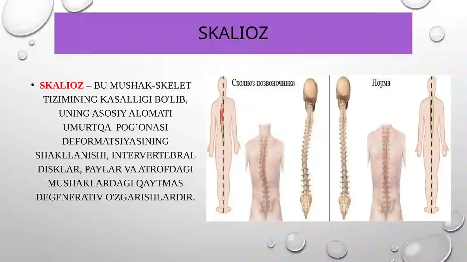 Skalioz kasalligi, tashxislash va kasallikni davolash usullari 2