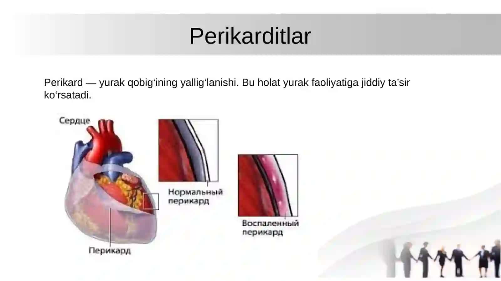 Perikarditlar 2