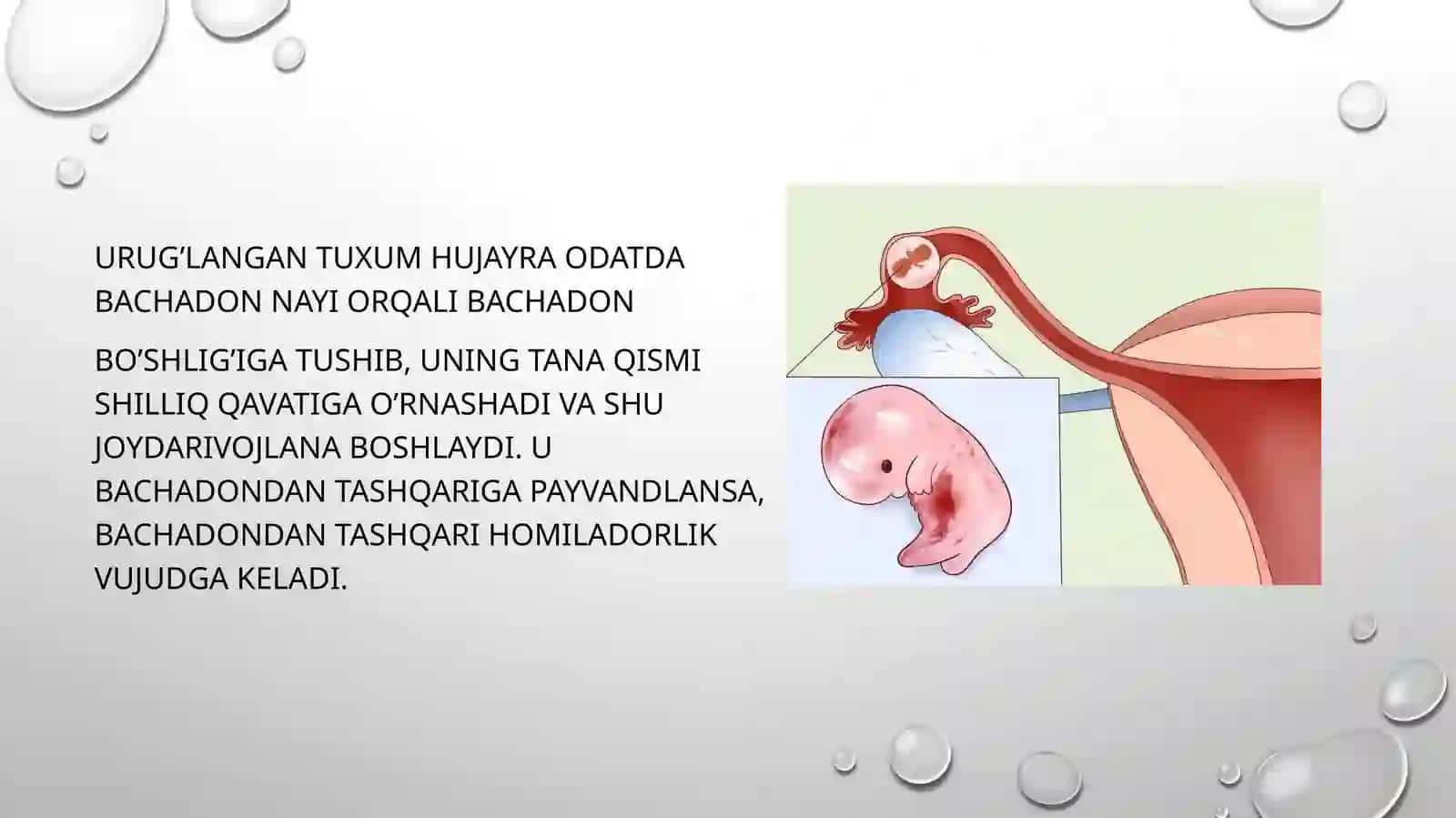 Bachadondan tashqari homiladorlik. Sabablari.Bachdondantashqari homiladorlik turlari.Tashxislashva tekshirish usullari 2