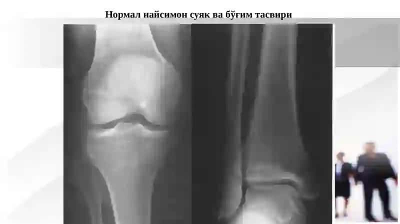 Мавзу: Суяк ва бўғимларнинг тараққий этиши, суяклар тузилиши таркиби ва рентгеноанатомияси 2