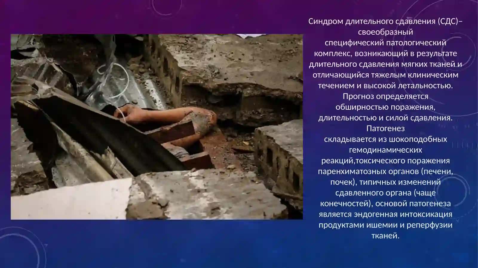 СИНДРОМ ДЛИТЕЛЬНОГО СДАВЛИВАНИЯ(КРАШ-СИНДРОМ) 2