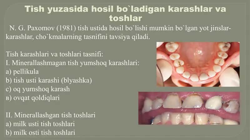 Tishkarashlari va Toshlarini tozalash usullari 2